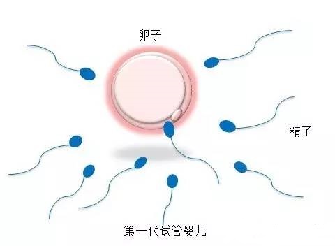 案例